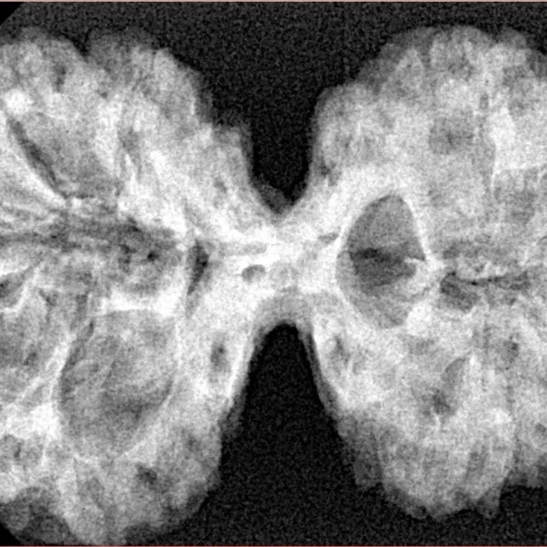 10 Mk Gaurishankar 38.6mm 7.47gm - Xray