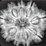 9 Mukhi Rudraksha 28.2mm 5.45gm - Xray