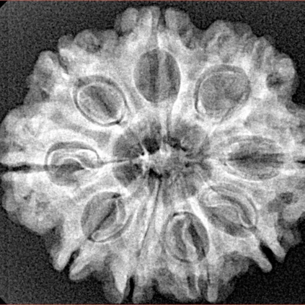 9 Mukhi Rudraksha 26.8mm 4.41gm - Xray