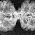9 MK Gaurishankar 39.6mm 5.65gm - Xray