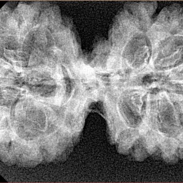9 MK Gaurishankar 39.6mm 5.65gm - Xray