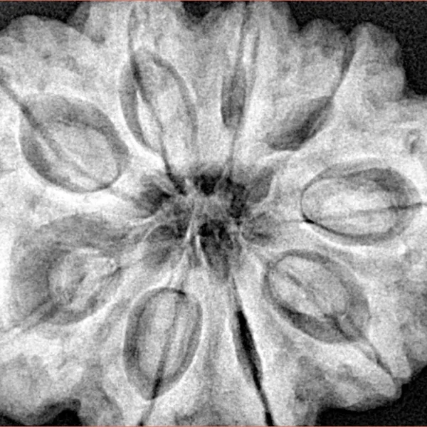 9 Mukhi Rudraksha 32.9mm 10.2gm - Xray