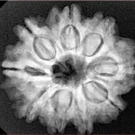 9 Mukhi Rudraksha 26.1mm 5.23gm - Xray