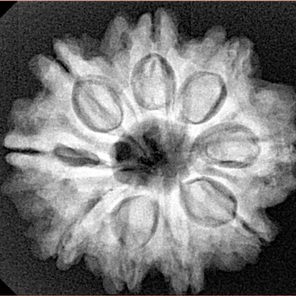 9 Mukhi Rudraksha 26.1mm 5.23gm - Xray