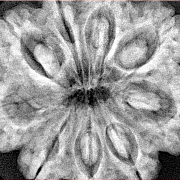 9 Mukhi Rudraksha 32.4mm 8.45gm - Xray