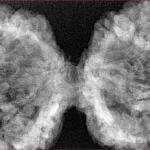 10 Mk Gaurishankar 47mm 9.6gm - Xray