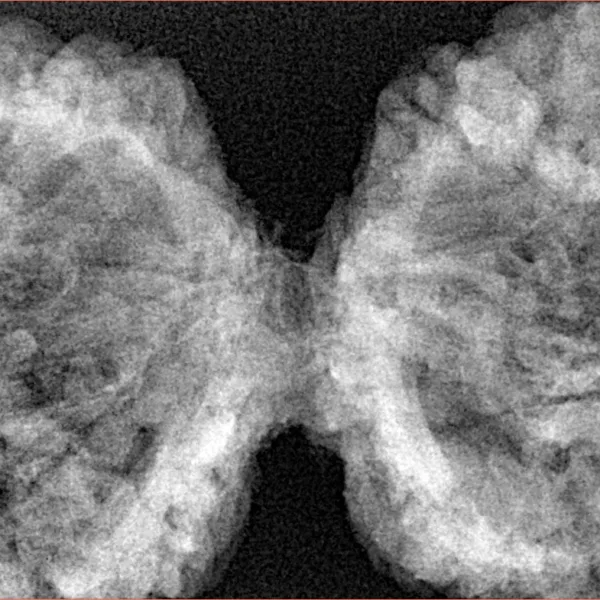 10 Mk Gaurishankar 47mm 9.6gm - Xray