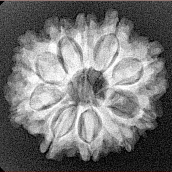 10 Mukhi Rudraksha 24.1mm 3.8gm - Xray