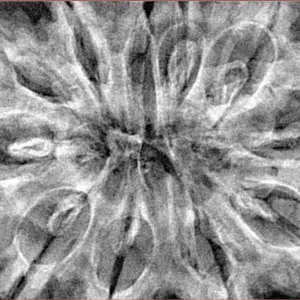 11 Mukhi Rudraksha 38.5mm 9gm - Xray