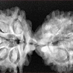 9 MK Gaurishankar 40.4mm 7.66gm - Xray