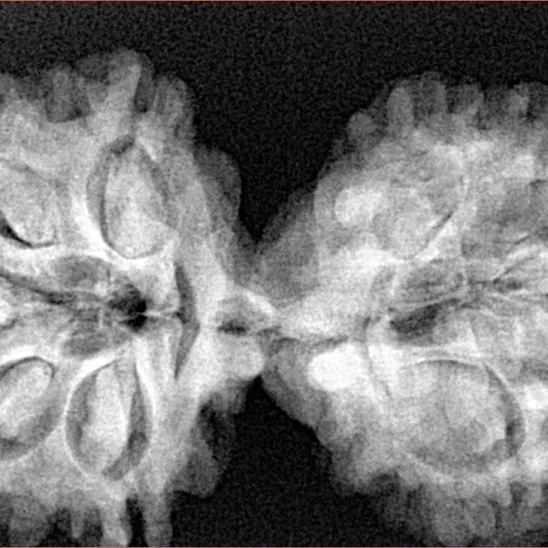 9 MK Gaurishankar 40.4mm 7.66gm - Xray