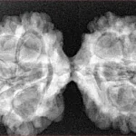 11 MK Gaurishankar 40.4mm 6.68gm - Xray
