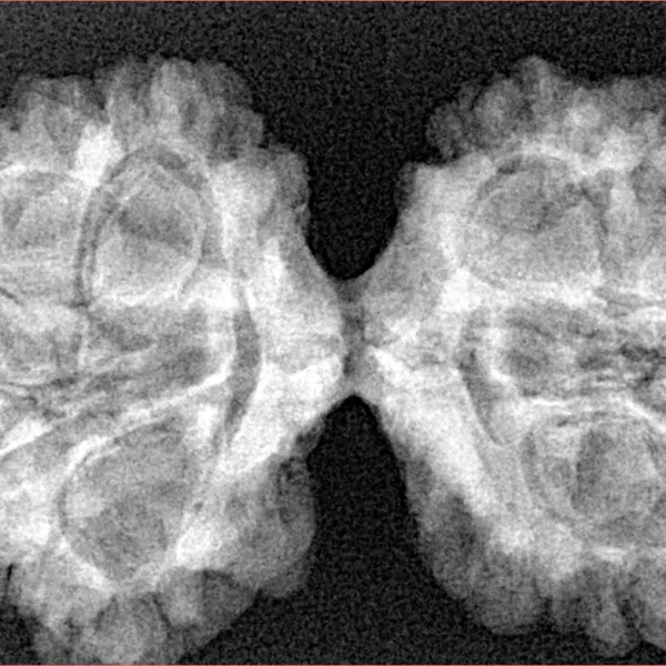 11 MK Gaurishankar 40.4mm 6.68gm - Xray