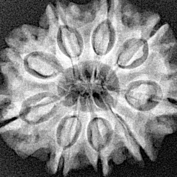 9 Mukhi Rudraksha 26.3mm 4.66gm - Xray