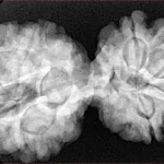 8 MK Gaurishankar 38.2mm 8.08gm - Xray