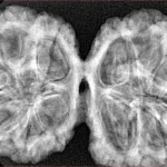 12 MK Gaurishankar 40.1mm 8.16gm - Xray