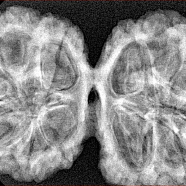 12 MK Gaurishankar 40.1mm 8.16gm - Xray