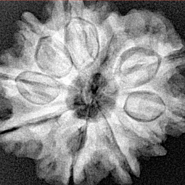 9 Mukhi Rudraksha 26mm 5gm - Xray