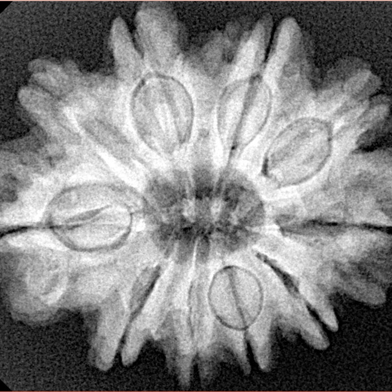 10 Mukhi Rudraksha 28.9mm 5.64gm - Xray