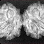 8 MK Gaurishankar 36.9mm 6.72gm - Xray