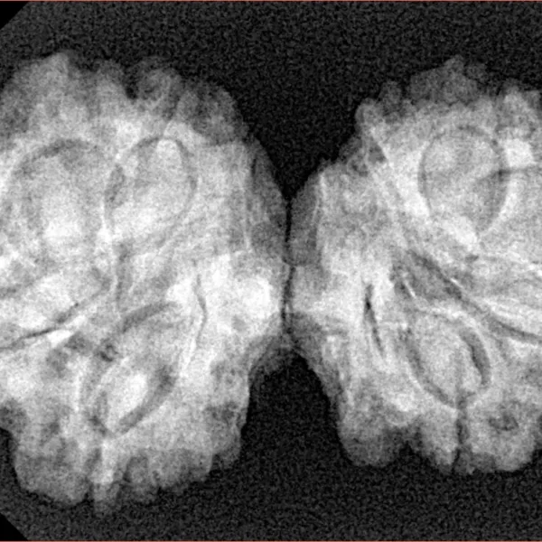 9 MK Gaurishankar 35.4mm 5.76gm - Xray