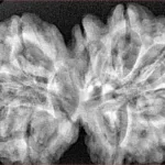 10 Mk Gaurishankar 38.7mm 8.52gm - Xray