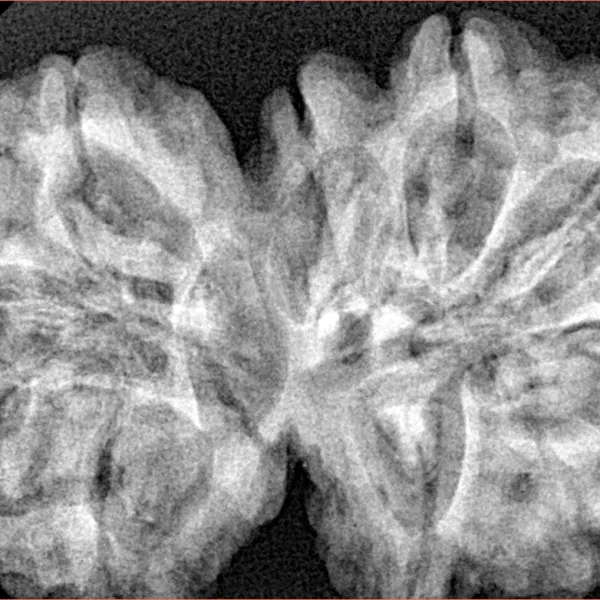 10 Mk Gaurishankar 38.7mm 8.52gm - Xray