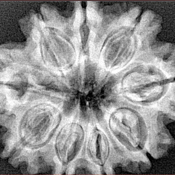 9 Mukhi Rudraksha 31.4mm 6.25gm - Xray