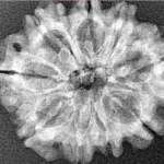 9 Mukhi Rudraksha 25.5mm 3.5gm - Xray