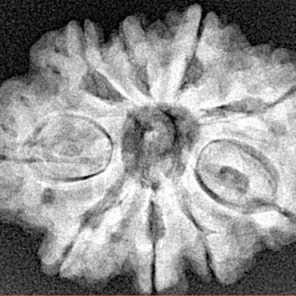 9 Mukhi Rudraksha 26.1mm 4.38gm - Xray
