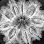 9 Mukhi Rudraksha 30.9mm 7.25gm - Xray