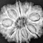 9 Mukhi Rudraksha 25.2mm 4.31gm - Xray