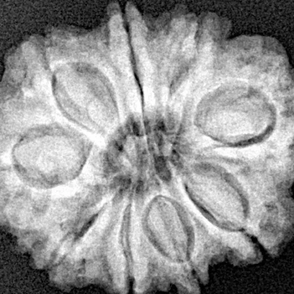 9 Mukhi Rudraksha 25.2mm 4.31gm - Xray