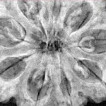 9 Mukhi Rudraksha 34mm 9.07gm - Xray