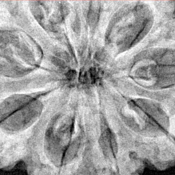 9 Mukhi Rudraksha 34mm 9.07gm - Xray