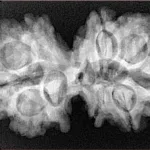 10 Mk Gaurishankar 34.8mm 6.27gm - Xray