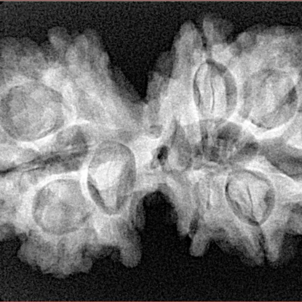 10 Mk Gaurishankar 34.8mm 6.27gm - Xray