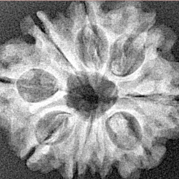 9 Mukhi Rudraksha 25.3mm 3.89gm - Xray