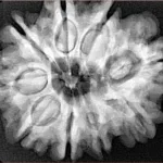 9 Mukhi Rudraksha 29mm 6.58gm - Xray