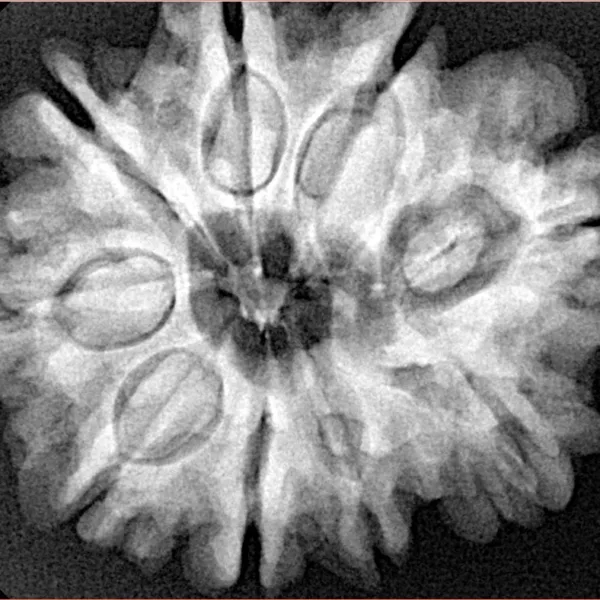 9 Mukhi Rudraksha 29mm 6.58gm - Xray