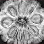 9 Mukhi Rudraksha 32.2mm 9gm - Xray