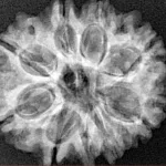 9 Mukhi Rudraksha 25.2mm 3.87gm - Xray