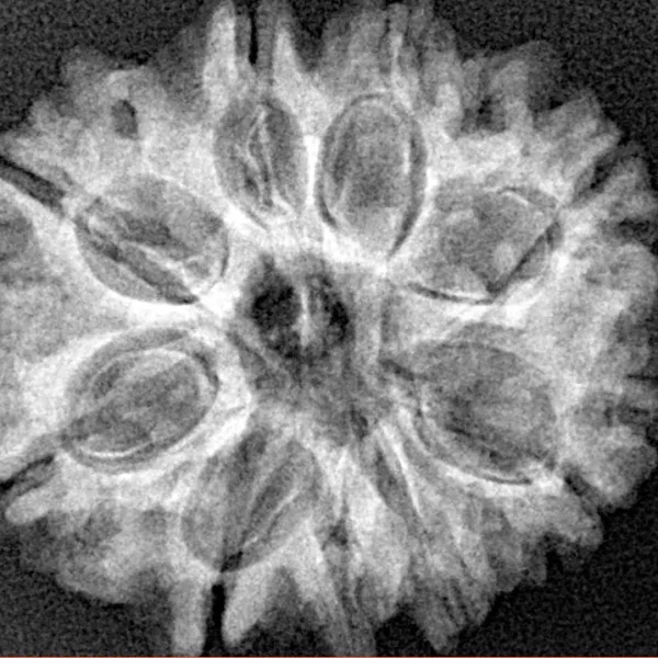 9 Mukhi Rudraksha 25.2mm 3.87gm - Xray