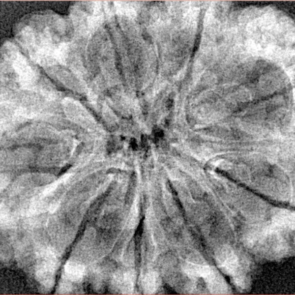 9 Mukhi Rudraksha 33.8mm 6.08gm - Xray