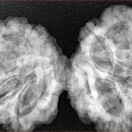 10 Mk Gaurishankar 40.5mm 8.69gm - Xray