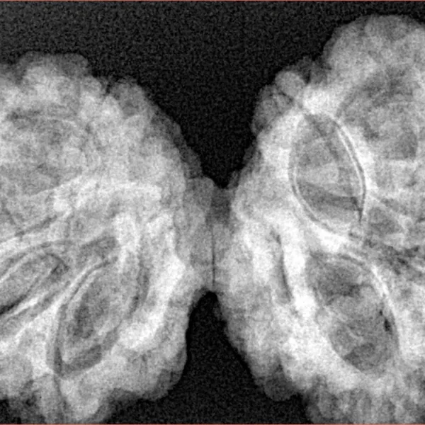 10 Mk Gaurishankar 40.5mm 8.69gm - Xray