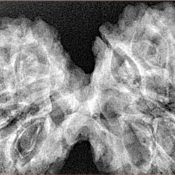 12 MK Gaurishankar 44.4mm 8.83gm - Xray
