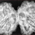 9 MK Gaurishankar 39mm 9.88gm - Xray