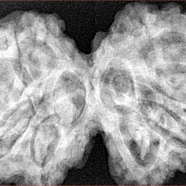 9 MK Gaurishankar 39mm 9.88gm - Xray