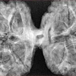 10 Mk Gaurishankar 43.4mm 9.48gm - Xray